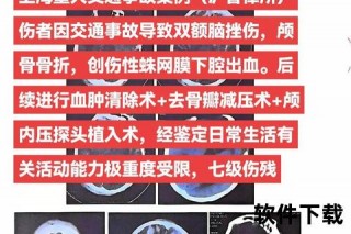 切赫的头盔之谜：颅骨重伤后的钢铁守护